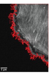 Figure from Reconstructing Actin Dynamics
