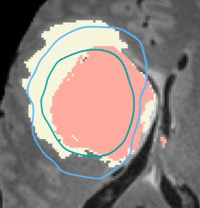 Figure from BiLO Operator Learning for PDEs
