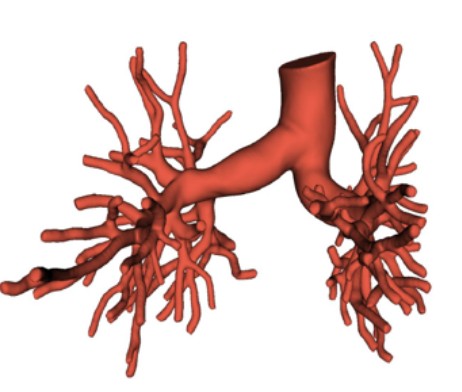 Figure from Murray Law in Pulmonary Arteries