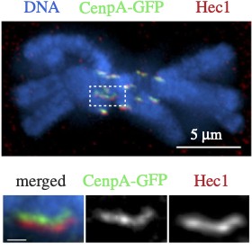 Figure from Kinetochore Morphology and Tension